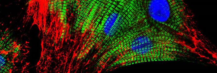 Neonatal Rat Cardiomyocytes Stained with Cross-adsorbed JIR Secondaries